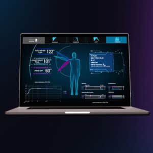 Exactech Predict+ Active Intelligence